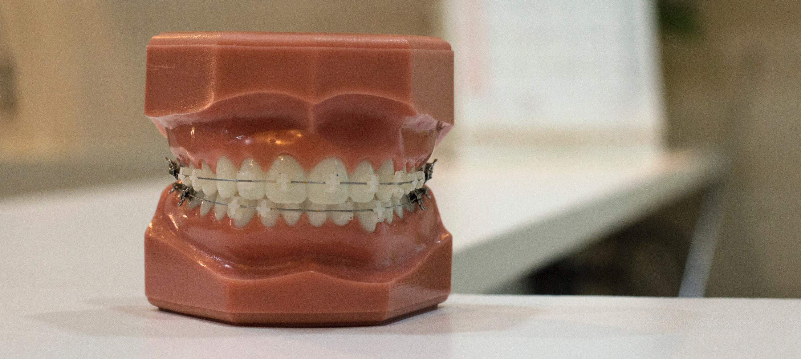 A model of teeth with braces.